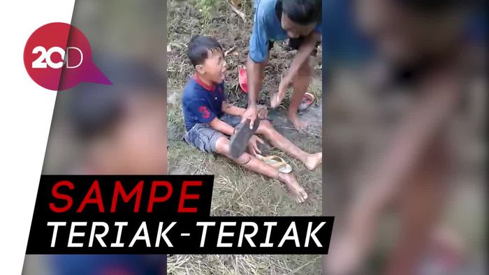 Kocak! Gaya Bocah yang Panik saat Tergigit Lintah