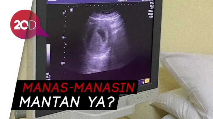 Istri Keenan Pearce Hamil, Netizen Singgung Raisa Kapan?