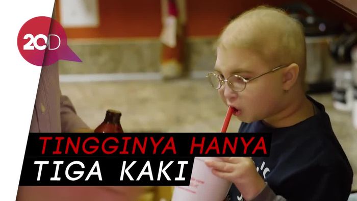 Bocah 7 Tahun Alami Kondisi Dwarfism yang Langka