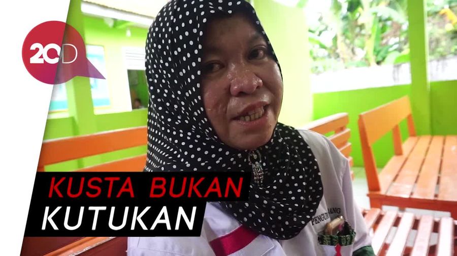 Kisah Rahma Sang Pejuang Penyakit Kusta