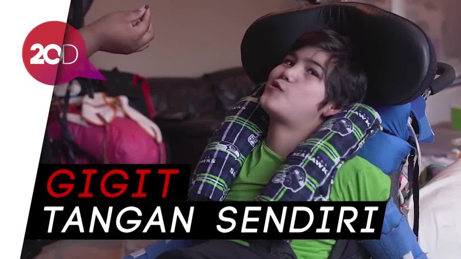 Penyakit Langka Bikin Bocah Ini Sering Menyakiti Diri Sendiri