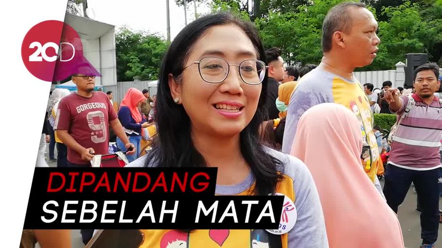Minimnya Lapangan Pekerjaan untuk Down Syndrome 