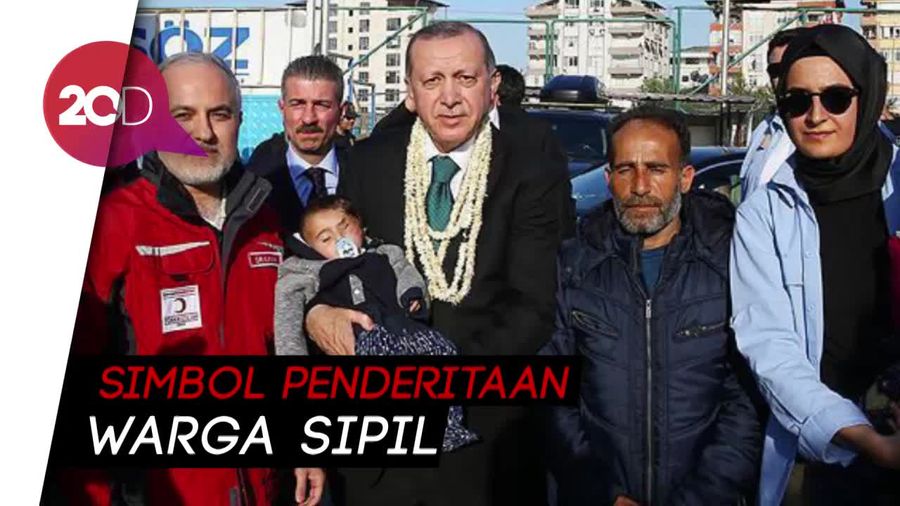 Bayi Karim Bermata Satu Digendong Presiden Turki
