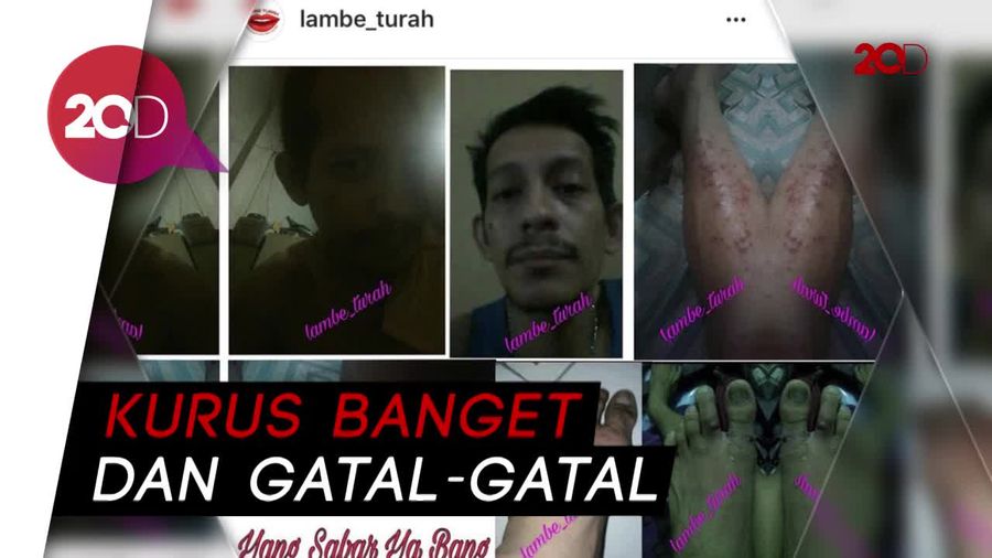 Kondisi Memprihatinkan Jupiter Fortissimo di Penjara