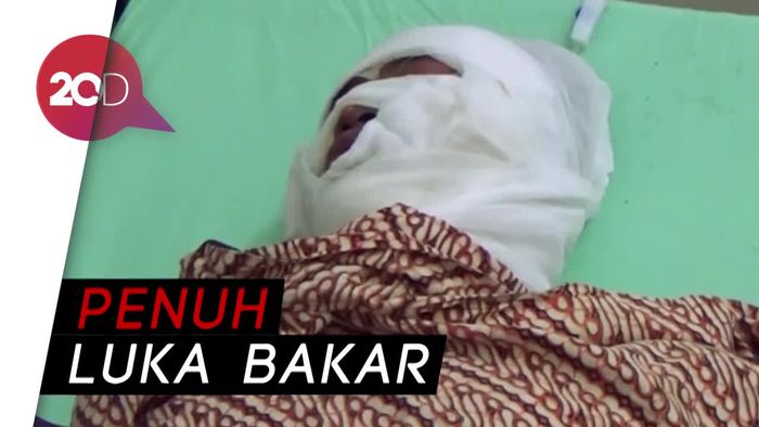 Kondisi Korban Ledakan Sumur Minyak Aceh
