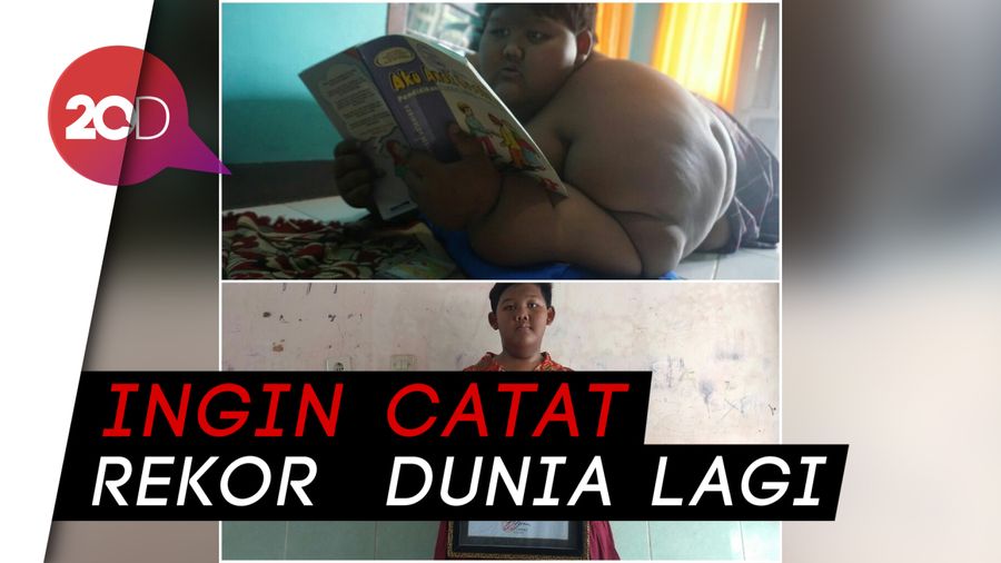 Kisah Diet Sukses Ariya Bocah Terberat di Dunia