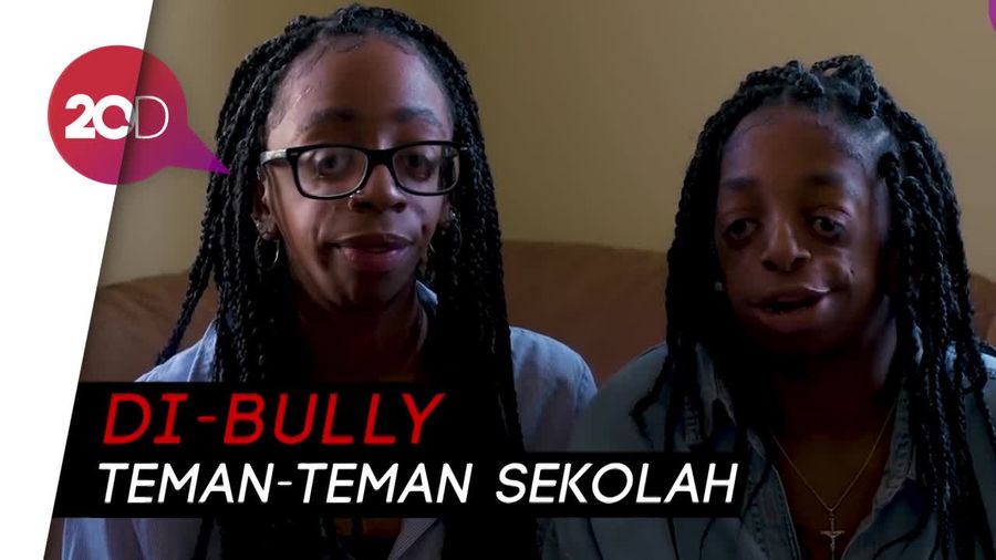 Kisah Menyentuh Remaja yang Di-bully karena Penyakit Langka