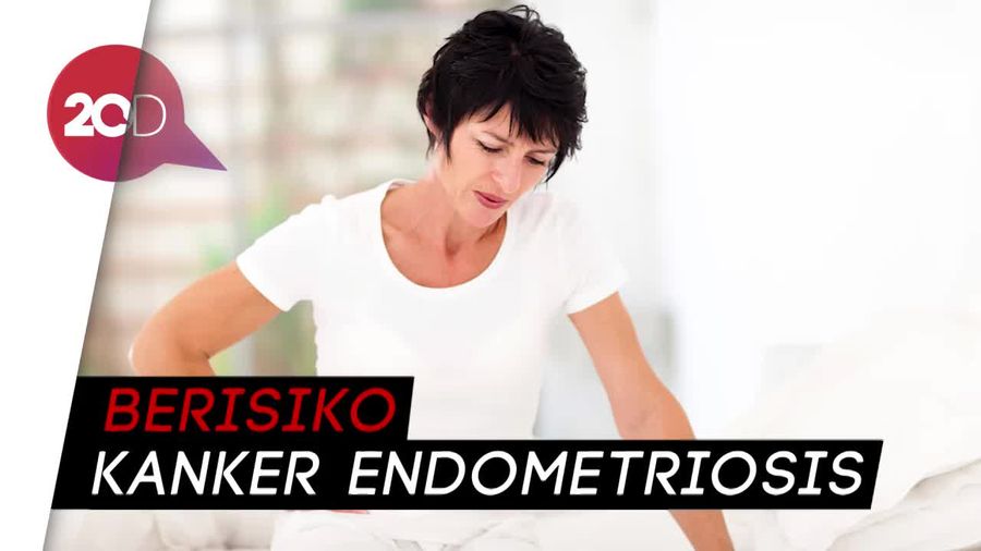 Ladies! Waspada Kalau Haid Tidak Teratur