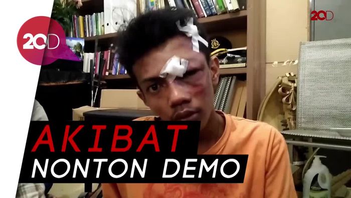 Cerita Warga yang Babak Belur Dihajar Anggota TNI