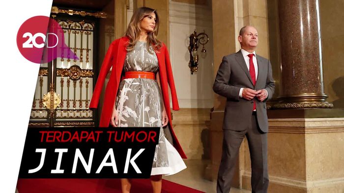 Melania Trump Jalani Operasi Ginjal