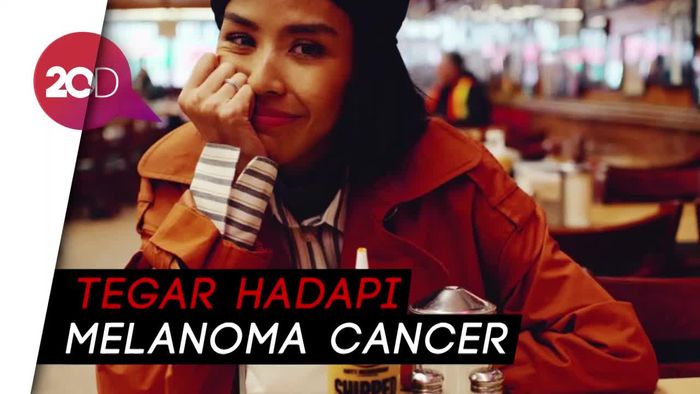 Proses Pemakaman Adara Taista, Menantu Hatta Rajasa