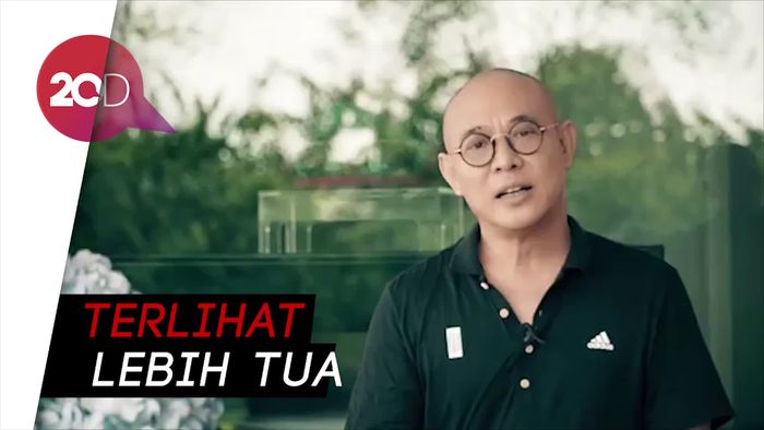 Memprihatinkan! Begini Kondisi Terkini Jet Li