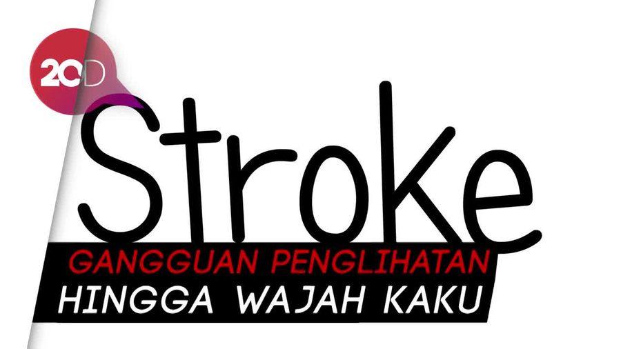 Hari Moekti Terkena Stroke, Kenali 5 Gejala Umumnya