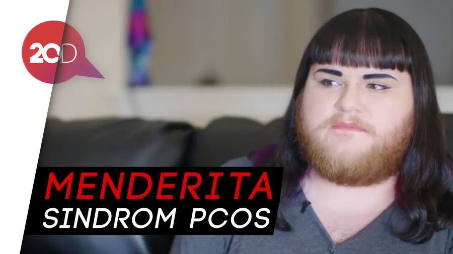Kisah Nova Galaxia si Wanita dengan Jenggot dan Kumis