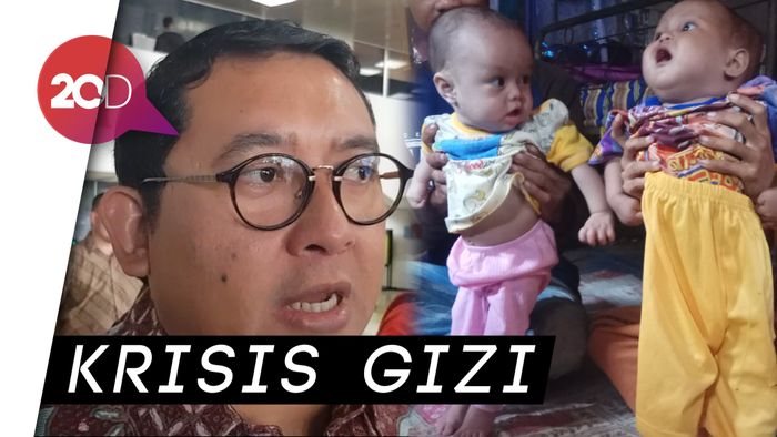 Kontroversi SKM, Fadli Zon 37% Anak Indonesia Stunting