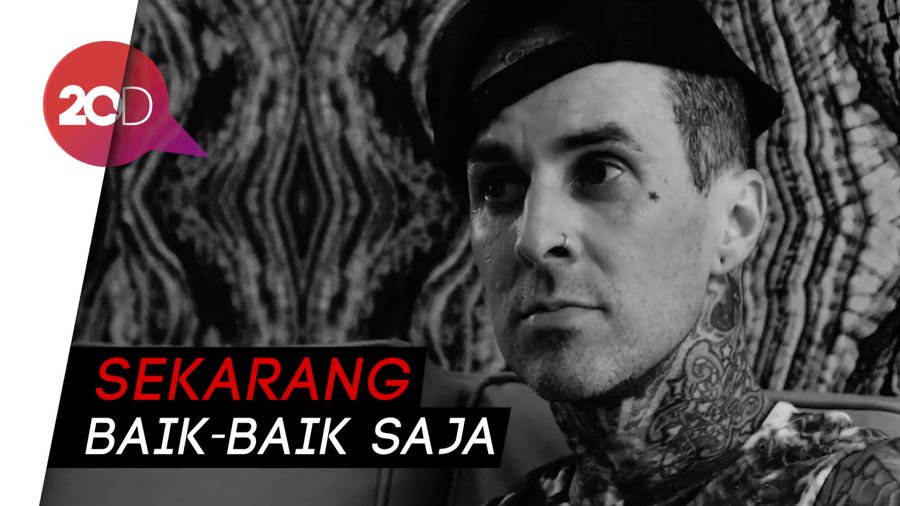 Kecelakaan, Begini Kondisi Terkini Drummer Blink 182