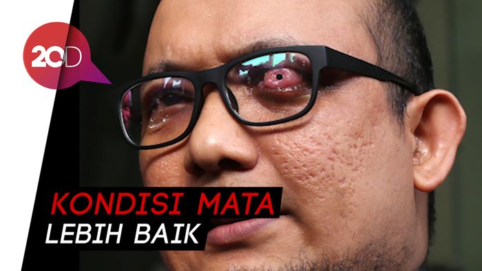 Kerja Lagi, Mata Novel Baswedan Sudah Sehat?
