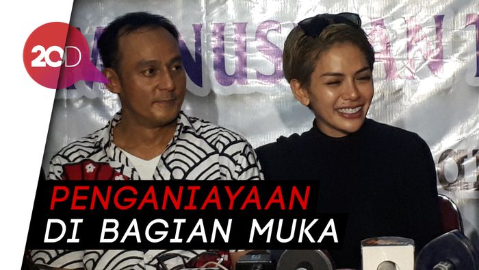 Dipo Latief Serahkan Bukti Visum KDRT Nikita Mirzani