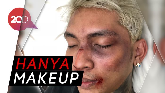 Ngaku Dipukulin Penggemar Kpop, Young Lex Malah Dibully
