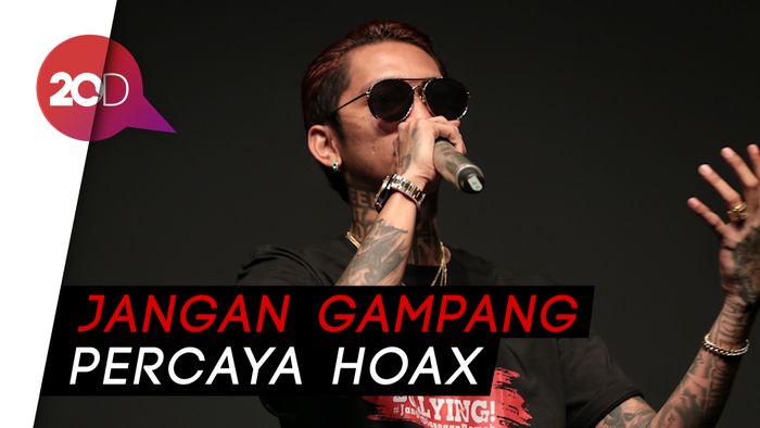 Ini Pengakuan Young Lex Soal Foto Wajah Babak Belur