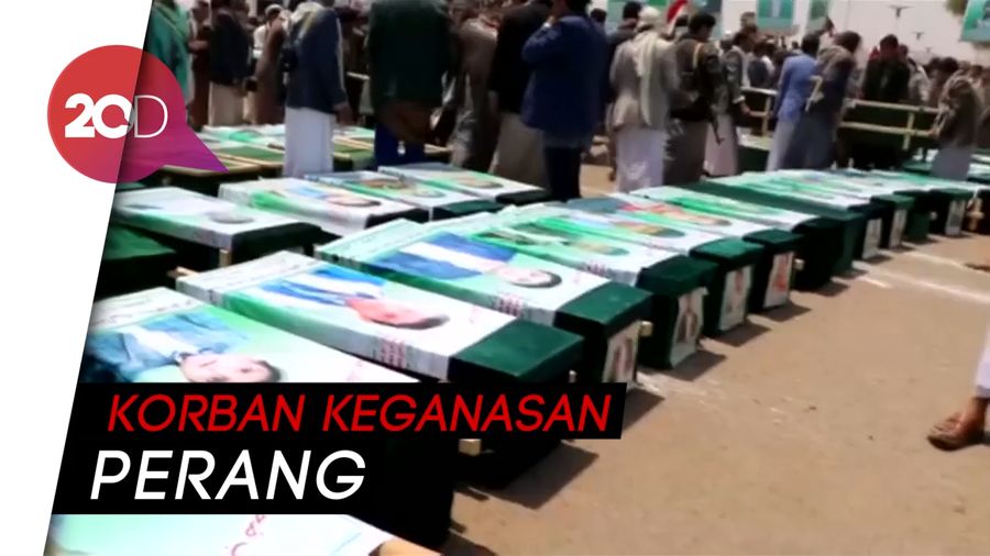 Nestapa Anak-anak Korban Perang Houthi Vs Arab Saudi