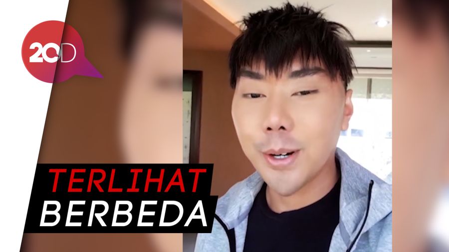 Tampil dengan Wajah Baru, Roy Kiyoshi Dihujat Netizen