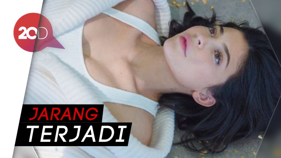 Tampil Tanpa Makeup, Kylie Jenner Tetap Cantik 