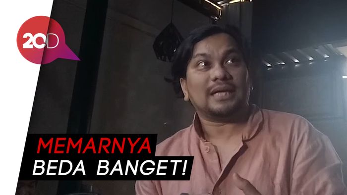 Curiga Sejak Awal, Ini Penjelasan Tompi soal Wajah Ratna Sarumpaet