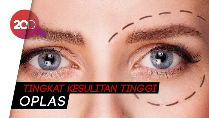 Mengapa Operasi Plastik Hasilnya Kadang Tak Memuaskan?
