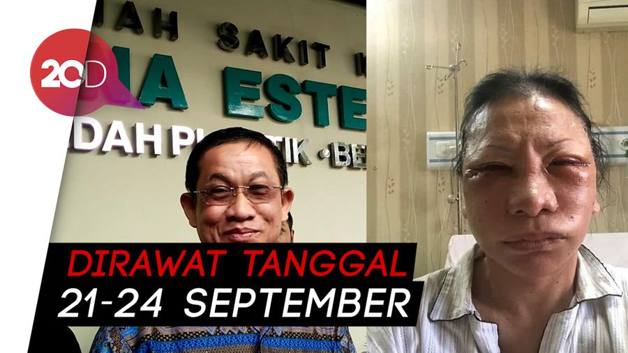  RS Bedah Bina Estetika Buka Suara soal Ratna Sarumpaet 