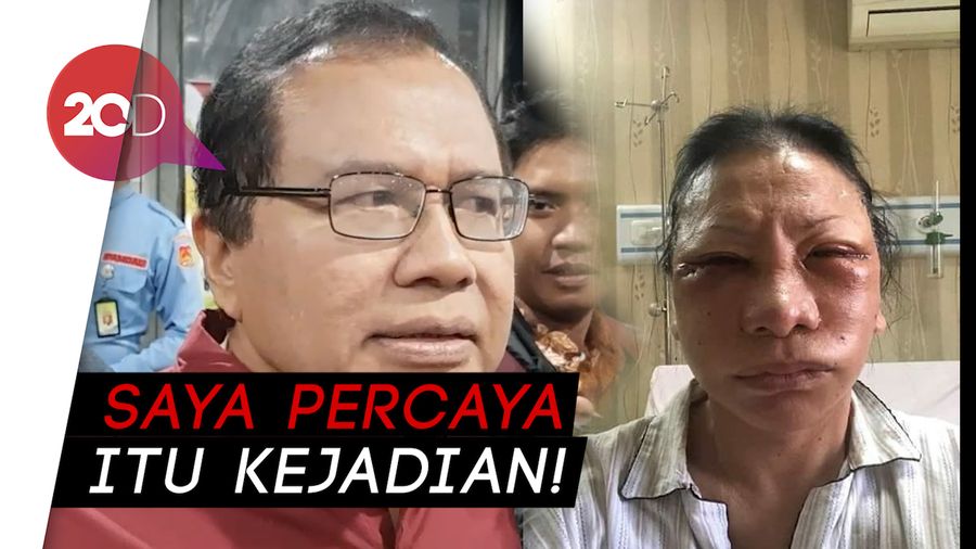 Rizal Ramli soal Ratna: Kalau Hasil Oplas Gitu, Bangkrut Tuh RS