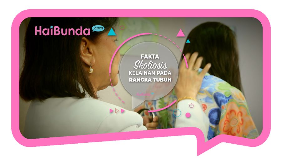 Fakta Skoliosis, Kelainan Pada Rangka Tubuh 