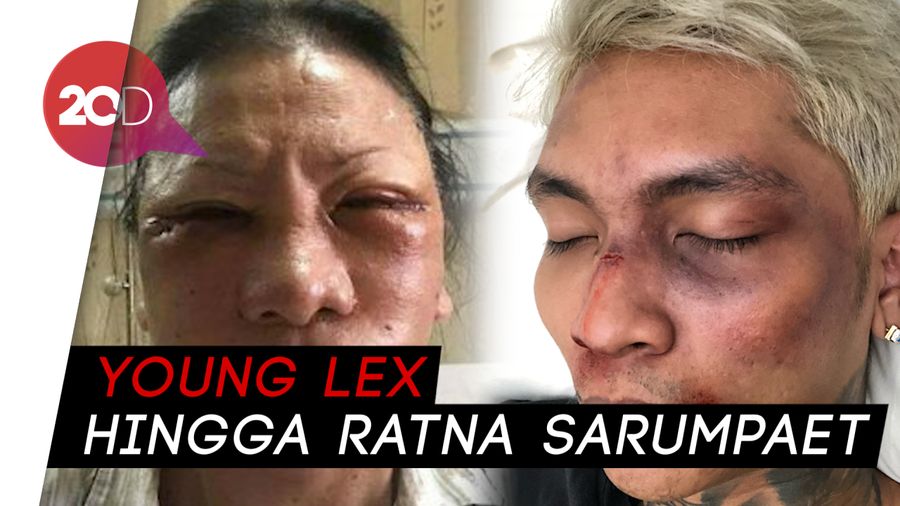 Deretan Kasus Hoaks Fenomenal: Ratna Sarumpaet hingga Young Lex