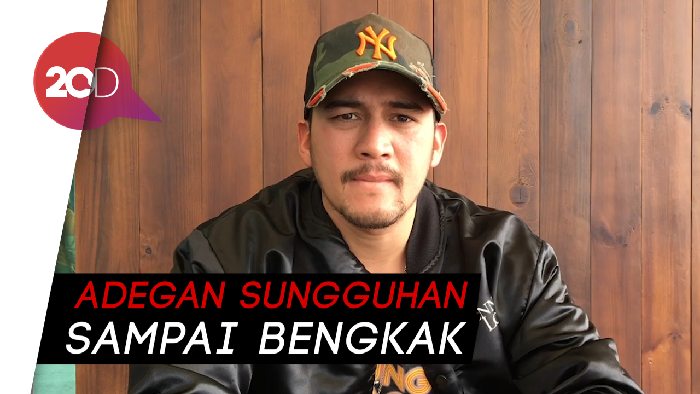 Adu Akting dengan Aurelie, Tangan Mario Lawalata Bengkak