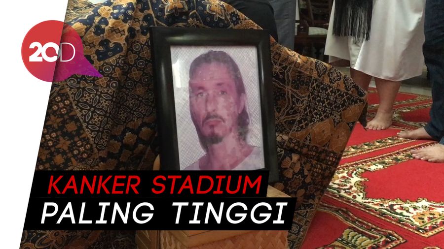 Idap Kanker Prostat, Rudy Wowor Masih Semangat Ingin Menari