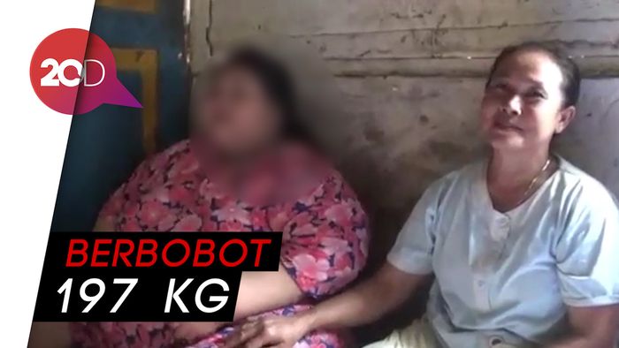 Malu Akibat Obesitas, Gadis di Lamongan Terpaksa Putus Sekolah
