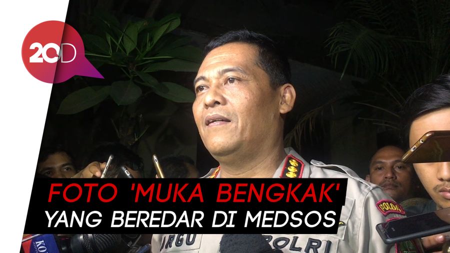 Atiqah Hasiholan Dimintai Keterangan soal Foto Ratna Sarumpaet