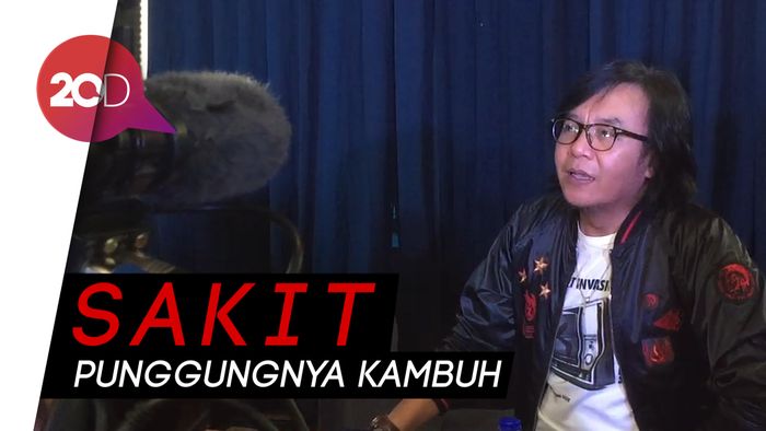 Ternyata Ini Alasan Ari Lasso Dilarikan ke Rumah Sakit