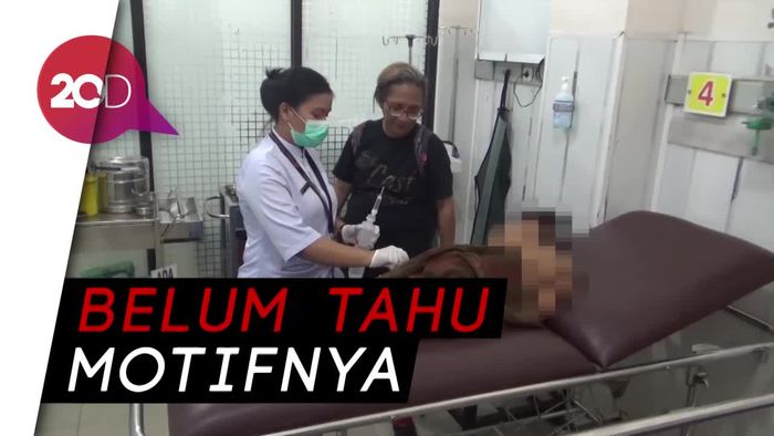 Nahas! Bocah 10 Tahun Dibakar 3 Temannya di Makassar
