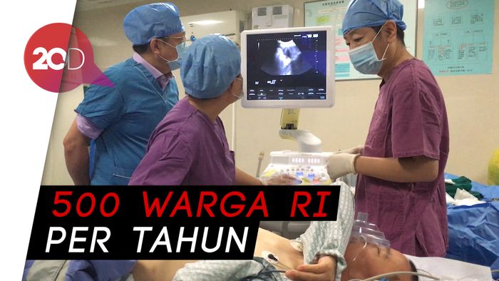 Cryosurgery, Pilihan Warga RI Saat Obati Kanker ke Guangzhou