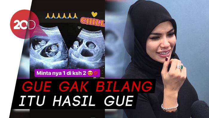 Nikita Mirzani Ngaku Nyolong Foto USG yang Dipostingnya