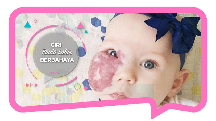 Ciri Tanda Lahir yang Berbahaya 