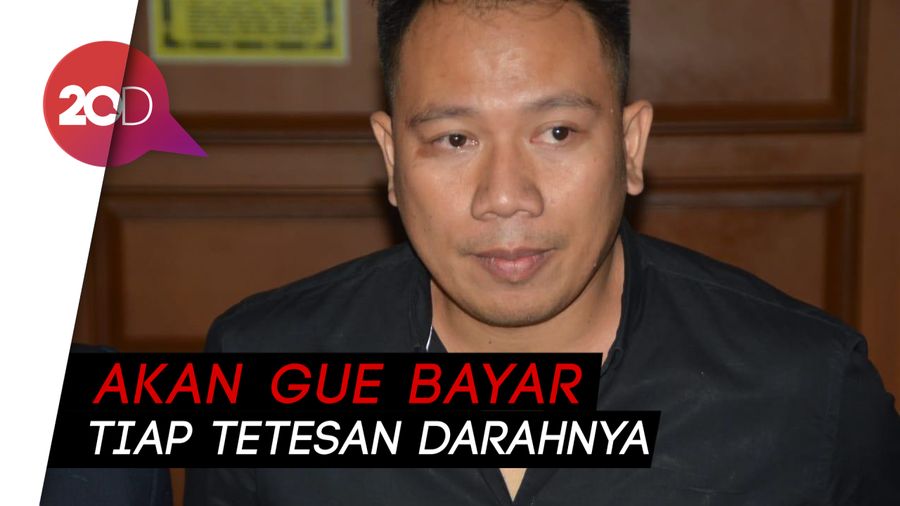 Vicky Prasetyo Geram Adiknya Dianiaya Sosok Misterius
