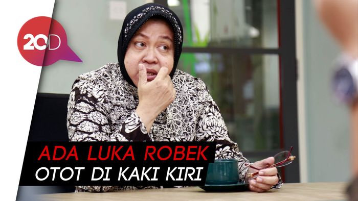 Duh, Bu Risma Cedera Kaki Karena Kelelahan