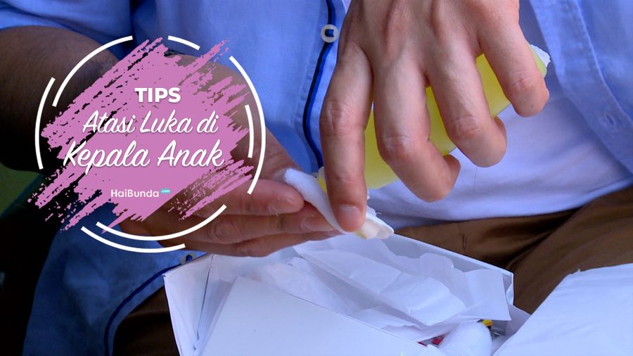 Tips Mengatasi Luka di Kepala Anak