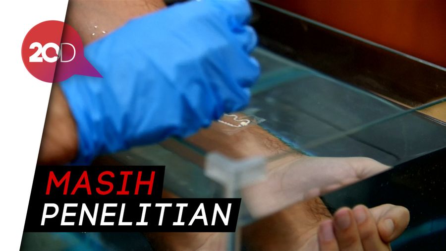 Alat Setipis Tato Temporer Untuk Meredakan Parkinson 