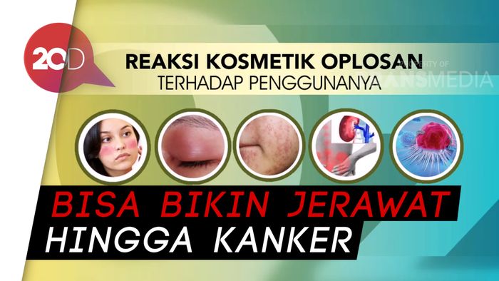 Kenali Bahaya Gunakan Kosmetik Oplosan Bersama Rahmawati Kekeyi
