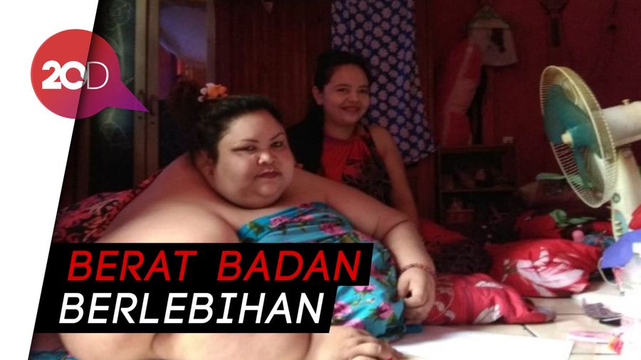 Wanita 350 Kg Sudah 6 Tahun Tak Bisa Berjalan