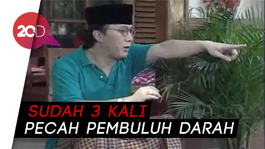 Infeksi Paru Jadi Penyebab Robby Tumewu Tutup Usia