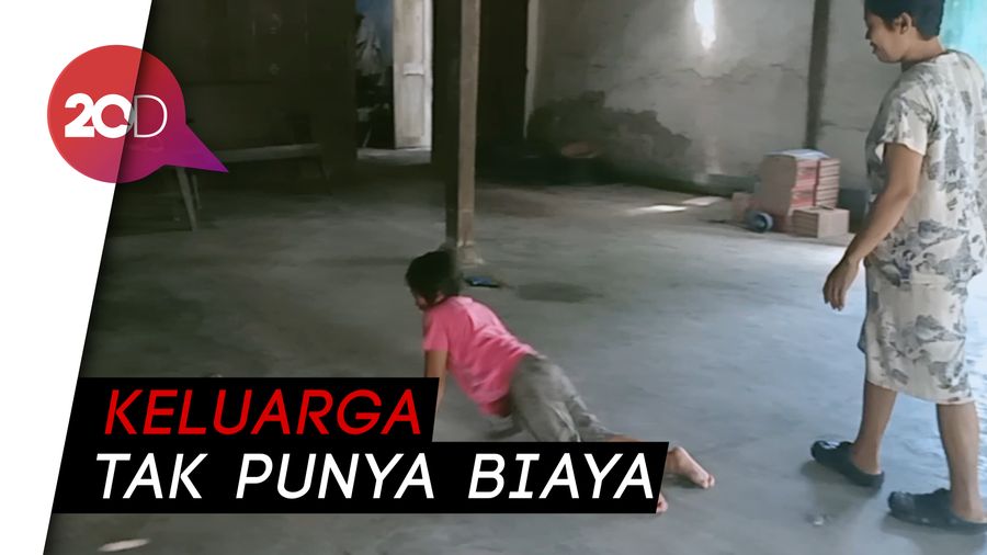 Sedih Lihat Bocah 7 Tahun Ini, Sehari-hari Ngesot karena Lumpuh
